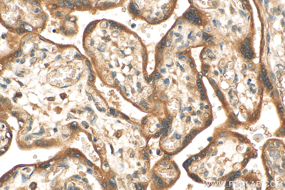 Immunohistochemistry (IHC) staining of human placenta tissue using KDSR Polyclonal antibody (16228-1-AP)