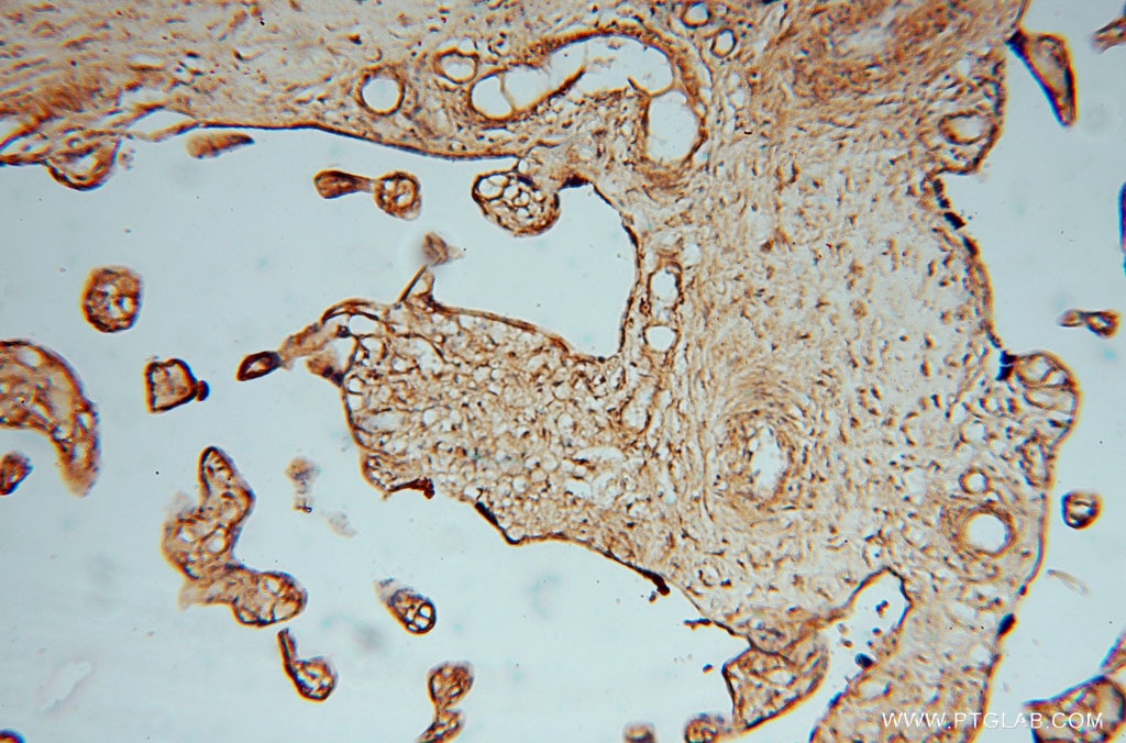 Immunohistochemistry (IHC) staining of human placenta tissue using KDSR Polyclonal antibody (16228-1-AP)