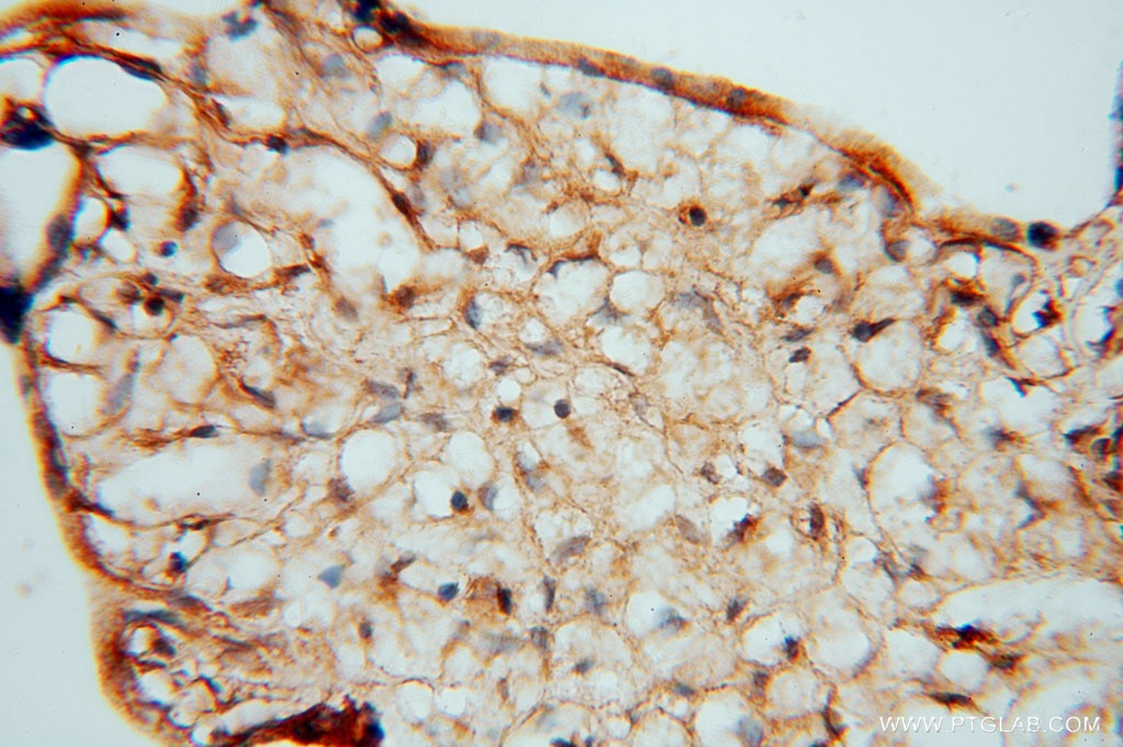 Immunohistochemistry (IHC) staining of human placenta tissue using KDSR Polyclonal antibody (16228-1-AP)