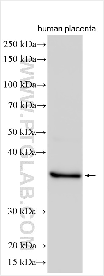 Western Blot (WB) analysis of human placenta tissue using KDSR Polyclonal antibody (16228-1-AP)