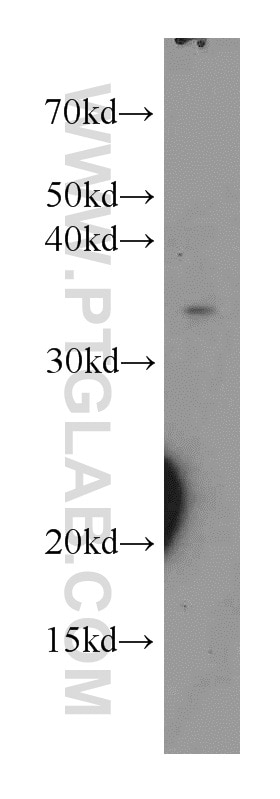 Western Blot (WB) analysis of human stomach tissue using KDSR Polyclonal antibody (16228-1-AP)