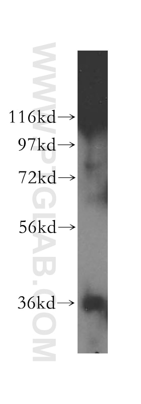 Western Blot (WB) analysis of human stomach tissue using KDSR Polyclonal antibody (16228-1-AP)