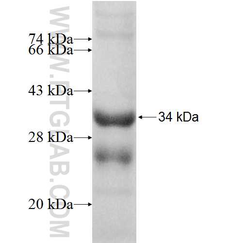 KDSR fusion protein Ag8198 SDS-PAGE