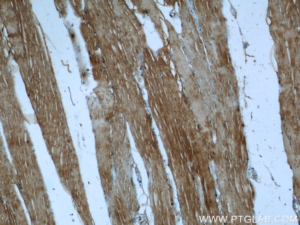 Immunohistochemistry (IHC) staining of human skeletal muscle tissue using KEAP1 Polyclonal antibody (10503-2-AP)