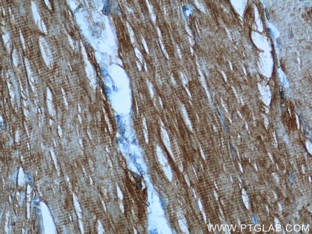 Immunohistochemistry (IHC) staining of human skeletal muscle tissue using KEAP1 Polyclonal antibody (10503-2-AP)