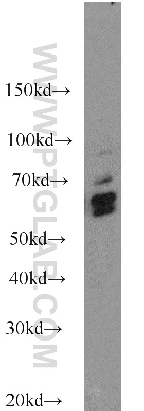 KEAP1 Polyclonal antibody