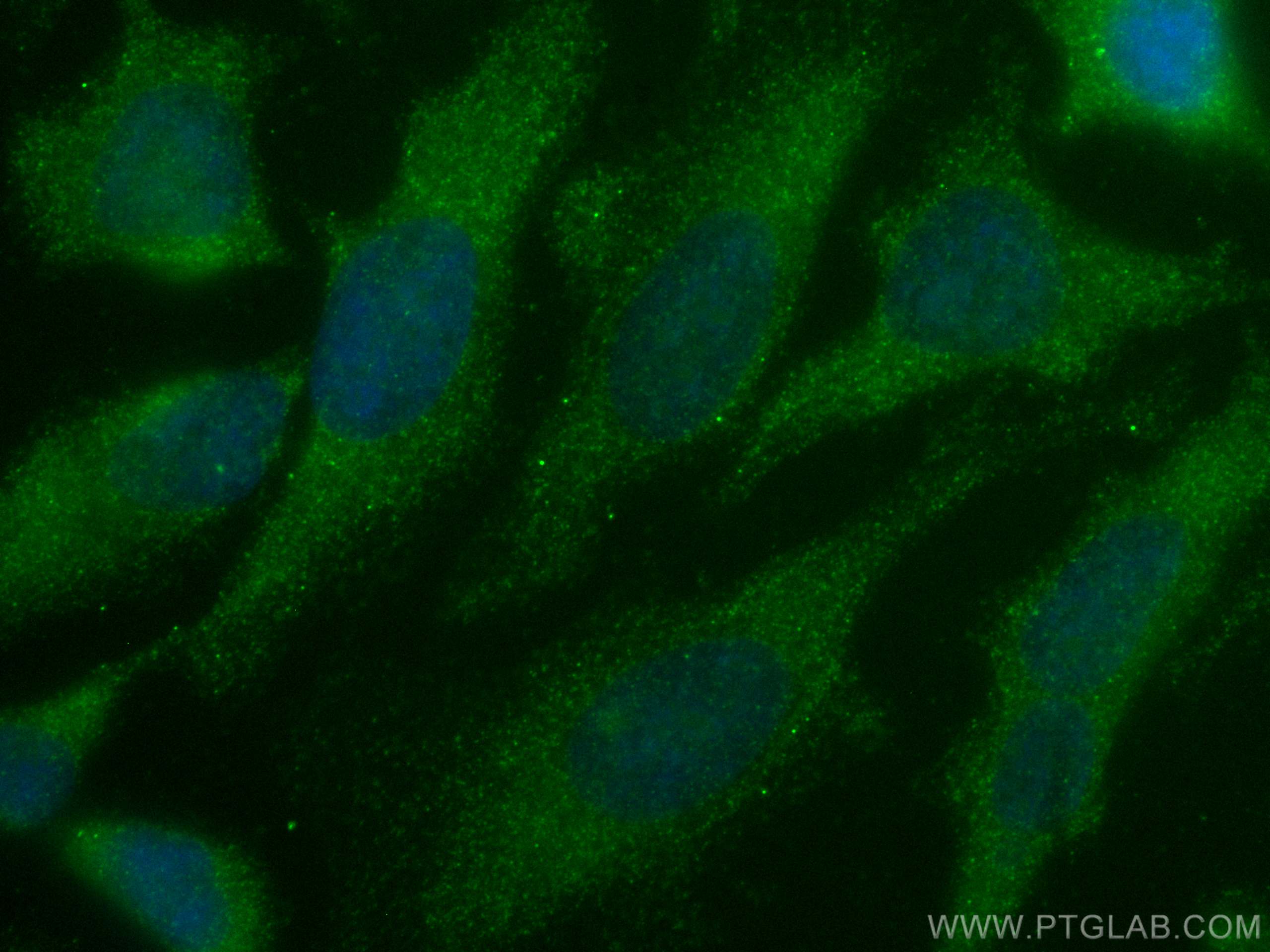 Immunofluorescence (IF) / fluorescent staining of HeLa cells using KEAP1 Monoclonal antibody (60027-1-Ig)