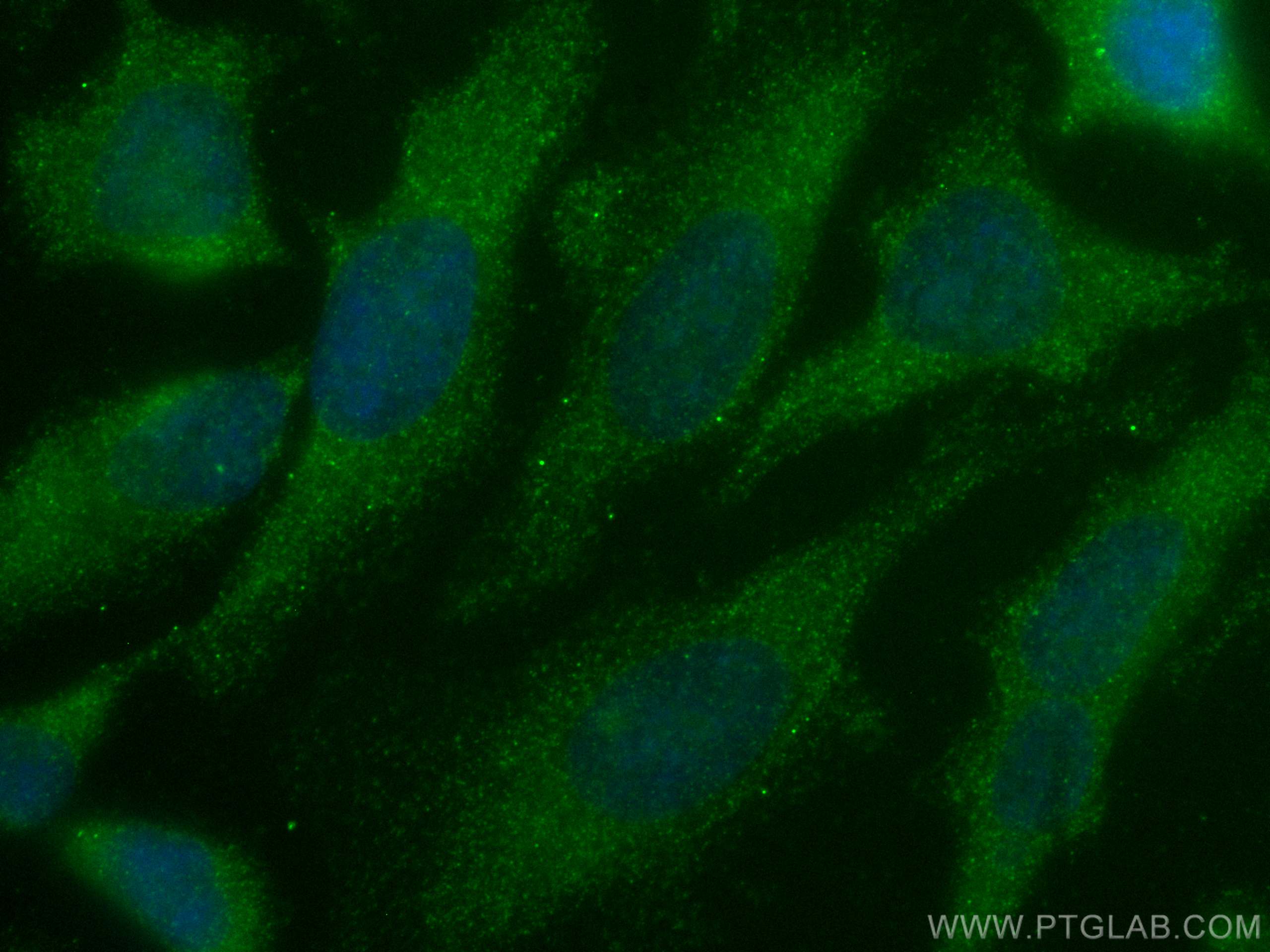 IF Staining of HeLa using 60027-1-Ig