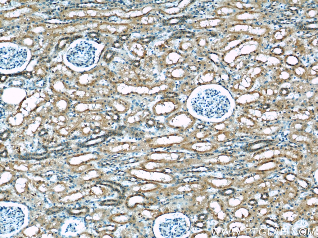 Immunohistochemistry (IHC) staining of human kidney tissue using KEAP1 Monoclonal antibody (60027-1-Ig)