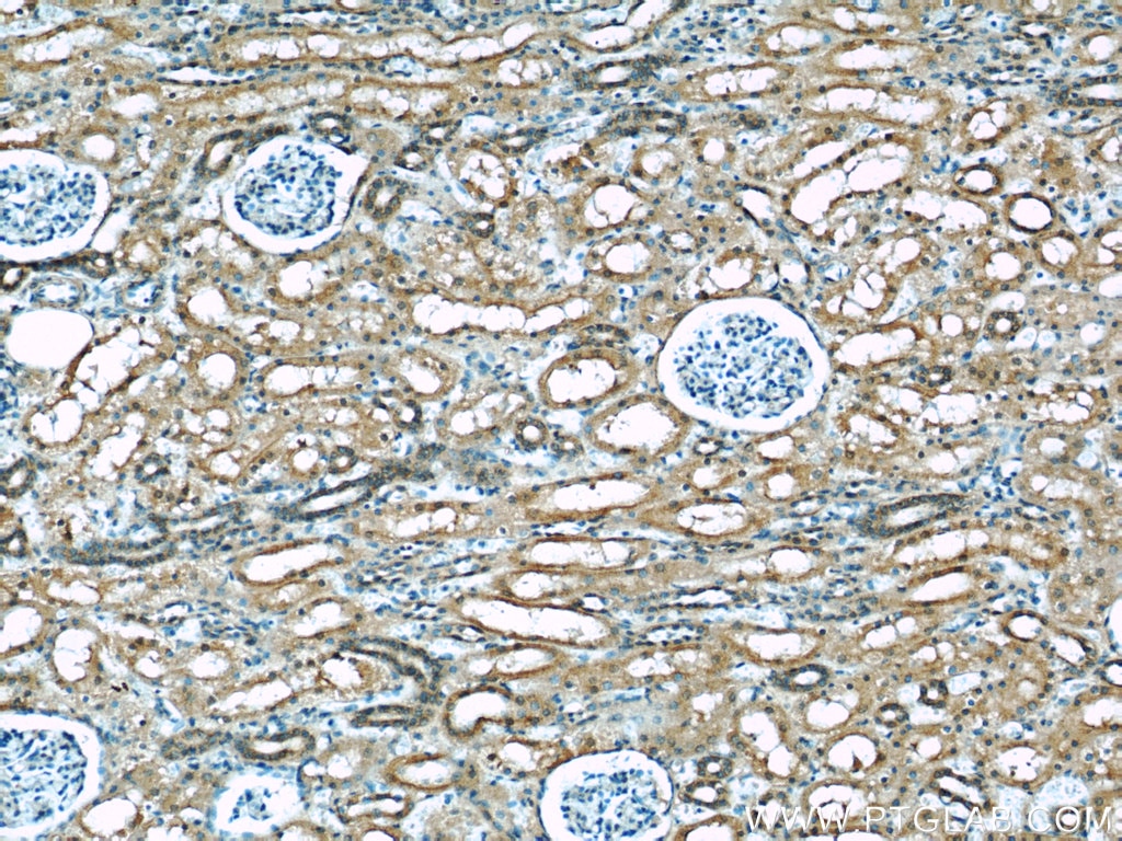 IHC staining of human kidney using 60027-1-Ig