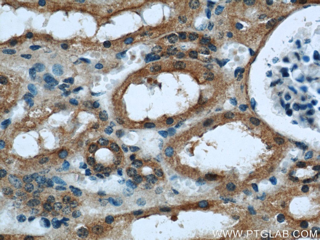 Immunohistochemistry (IHC) staining of human kidney tissue using KEAP1 Monoclonal antibody (60027-1-Ig)