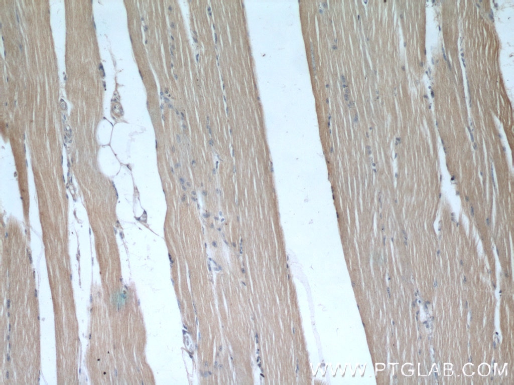 Immunohistochemistry (IHC) staining of human skeletal muscle tissue using KEAP1 Monoclonal antibody (60027-1-Ig)