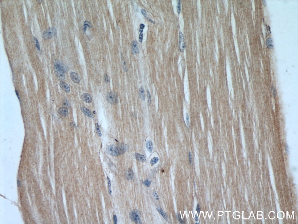 IHC staining of human skeletal muscle using 60027-1-Ig