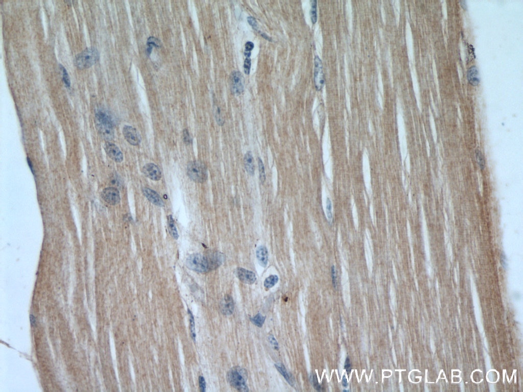 Immunohistochemistry (IHC) staining of human skeletal muscle tissue using KEAP1 Monoclonal antibody (60027-1-Ig)