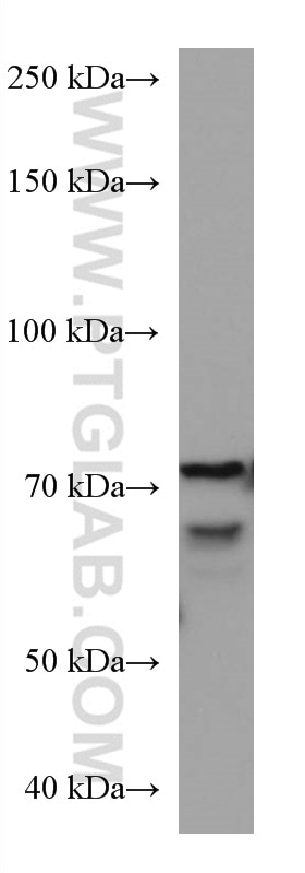 Western Blot (WB) analysis of Jurkat cells using KEAP1 Monoclonal antibody (60027-1-Ig)