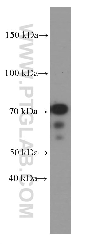 Western Blot (WB) analysis of MCF-7 cells using KEAP1 Monoclonal antibody (60027-1-Ig)