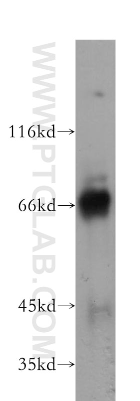 Western Blot (WB) analysis of HeLa cells using KEAP1 Monoclonal antibody (60027-1-Ig)