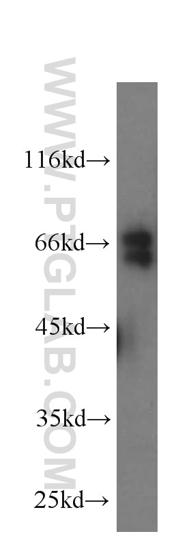 Western Blot (WB) analysis of Jurkat cells using KEAP1 Monoclonal antibody (60027-1-Ig)