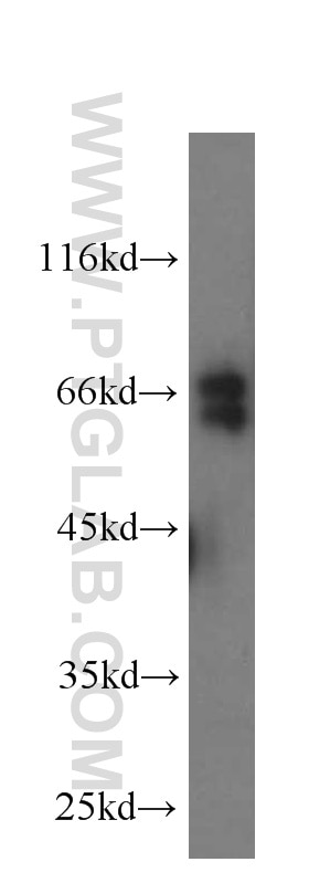 WB analysis of Jurkat using 60027-1-Ig