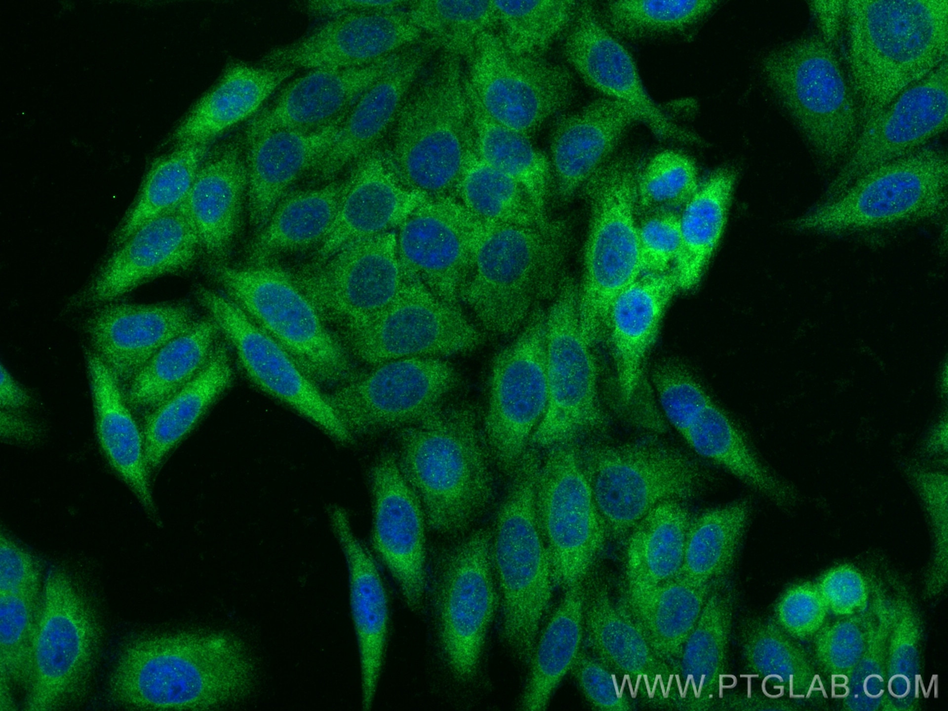 Immunofluorescence (IF) / fluorescent staining of HepG2 cells using KEAP1 Recombinant antibody (80744-1-RR)