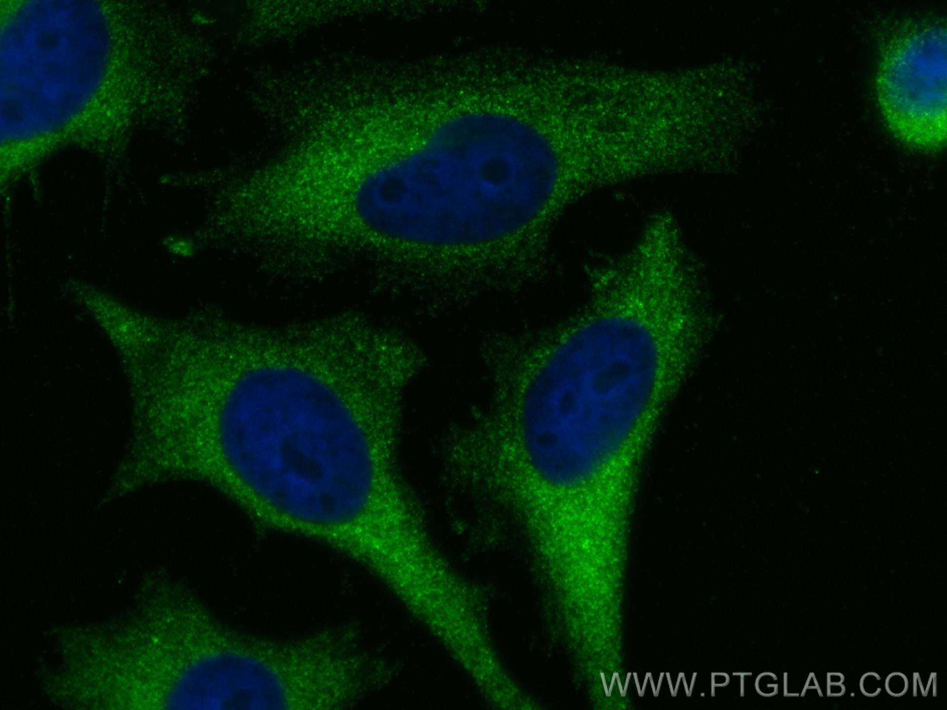 Immunofluorescence (IF) / fluorescent staining of HeLa cells using KEAP1 Recombinant antibody (80744-1-RR)