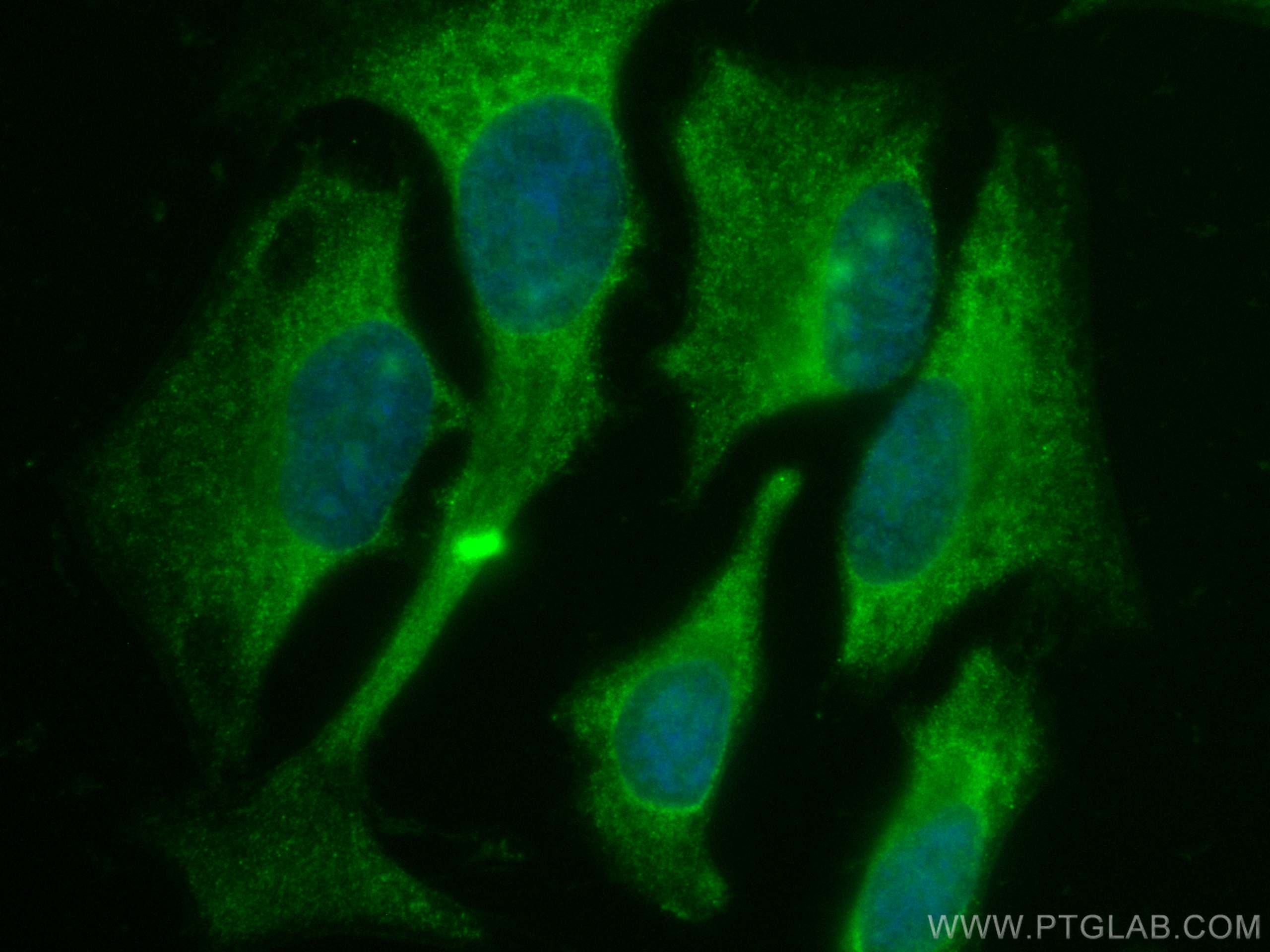 Immunofluorescence (IF) / fluorescent staining of HeLa cells using CoraLite® Plus 488-conjugated KEAP1 Monoclonal ant (CL488-60027)