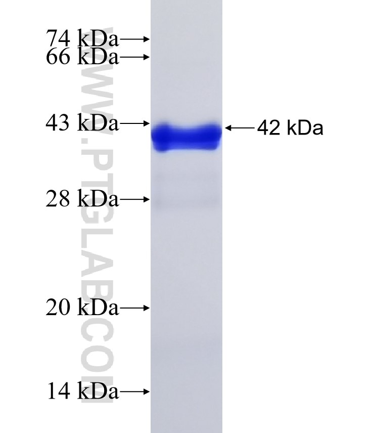 KEAP1 fusion protein Ag32512 SDS-PAGE