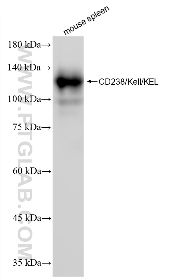 Western Blot (WB) analysis of various lysates using KEL Recombinant monoclonal antibody (87688-3-RR)