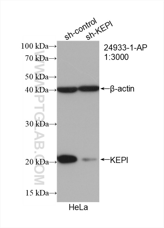 Western Blot (WB) analysis of HeLa cells using KEPI Polyclonal antibody (24933-1-AP)