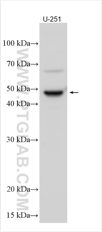 Western Blot (WB) analysis of various lysates using KERA Polyclonal antibody (13728-1-AP)