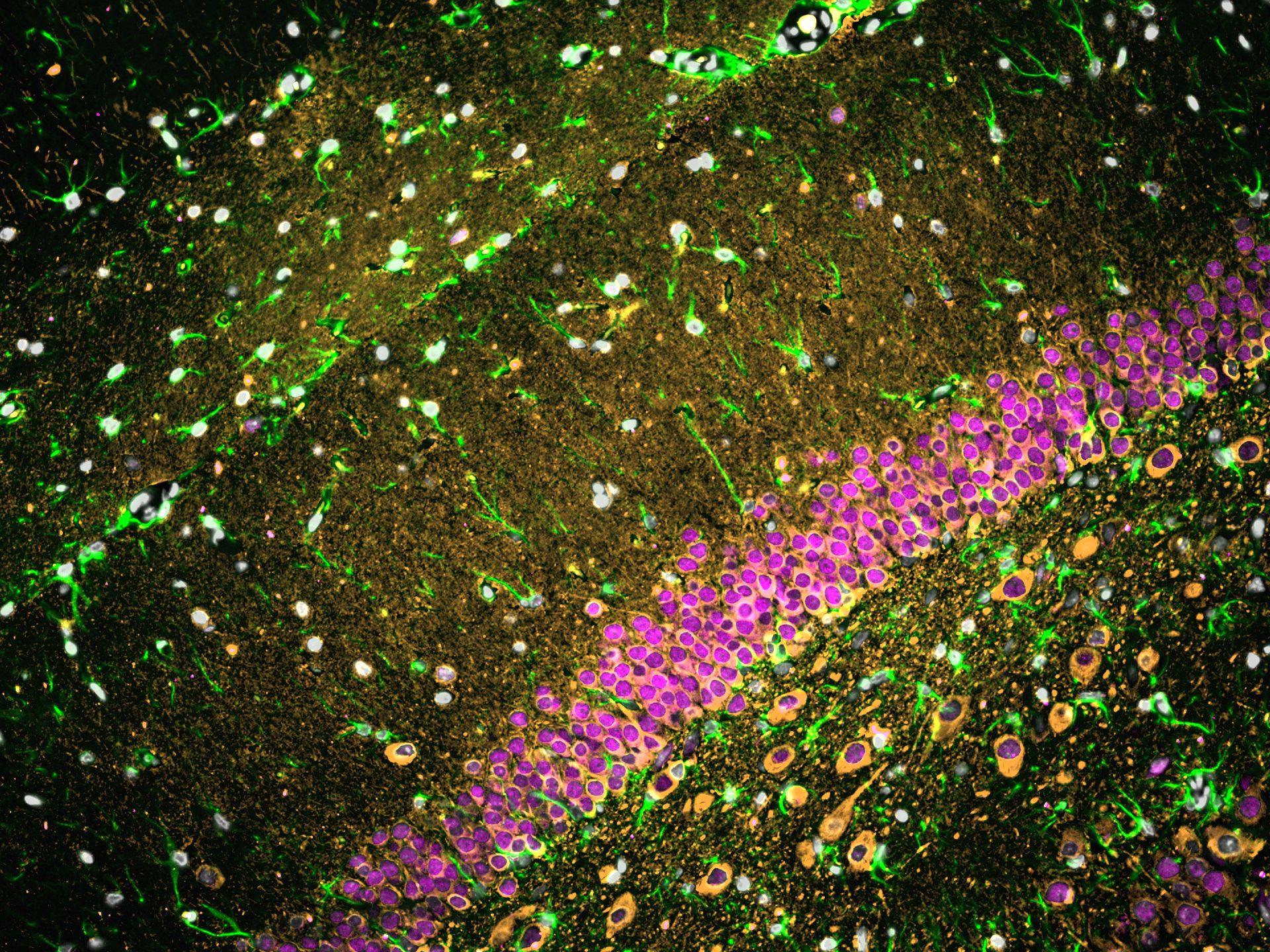 Immunofluorescence of rat brain tissue: FFPE rat brain tissue sections were stained with anti-NeuN (66836-1-Ig) labeled with FlexAble CoraLite® Plus 650 Kit (KFA023, magenta), anti-TUBB3 (66375-1-Ig) labeled with FlexAble CoraLite® Plus 550 Kit (KFA022, orange), and CoraLite®488-conjugated GFAP antibody (CL488-60190, green).