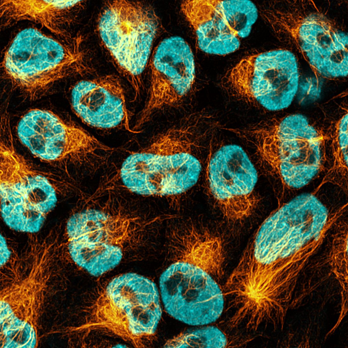Immunofluorescence of HeLa: PFA-fixed HeLa cells were stained with anti-Vimentin labeled with FlexAble CoraLite® Plus 555 Kit (KFA022, yellow) and anti-hnRNP labeled with FlexAble CoraLite® Plus 647 Kit (KFA023, cyan).​ Confocal images were acquired with a 100x oil objective and post-processed. Images were recorded at the Core Facility Bioimaging at the Biomedical Center, LMU Munich.