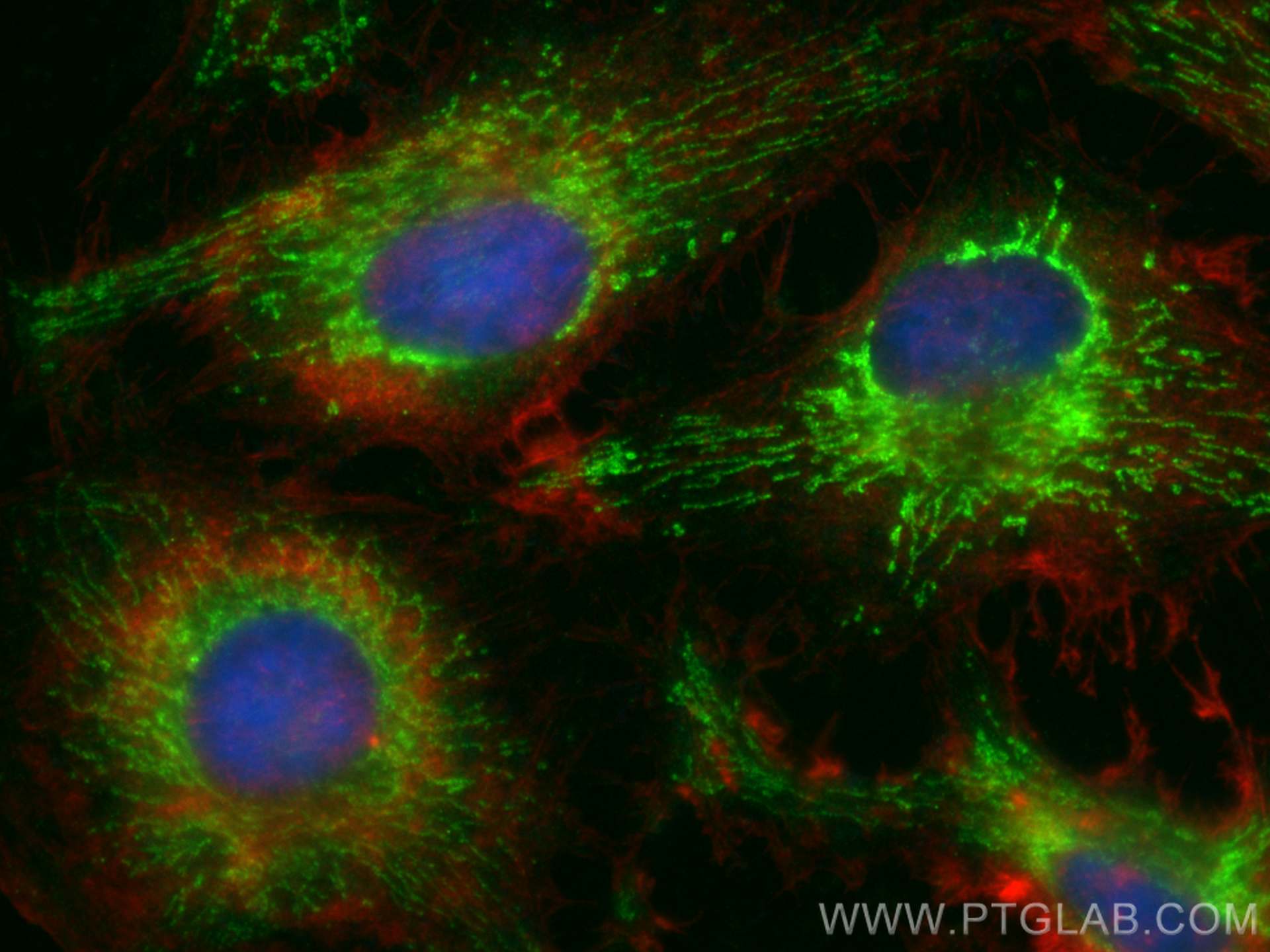 Immunofluorescence (IF) / fluorescent staining of HeLa cells using CoraLite® Plus 488-conjugated KGA/GAM/GAC Polyclon (CL488-23549)