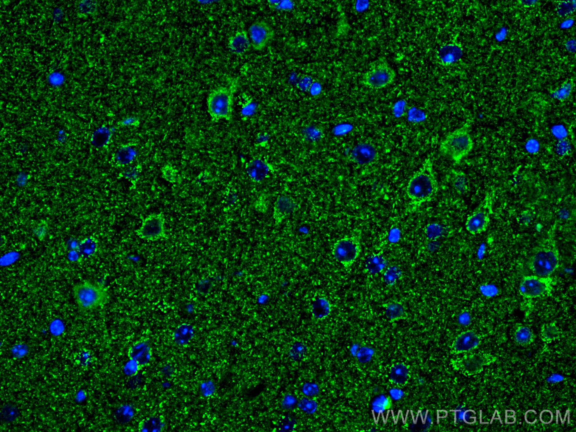 Immunofluorescence (IF) / fluorescent staining of mouse brain tissue using KGA-Specific Monoclonal antibody (66265-2-Ig)