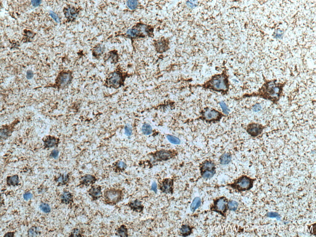 Immunohistochemistry (IHC) staining of mouse brain tissue using KGA-Specific Monoclonal antibody (66265-2-Ig)