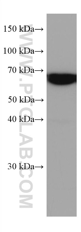 Western Blot (WB) analysis of COLO 320 cells using KGA-Specific Monoclonal antibody (66265-2-Ig)