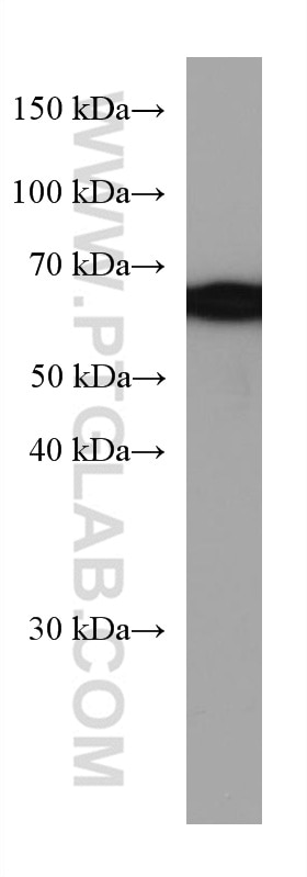 Western Blot (WB) analysis of HSC-T6 cells using KGA-Specific Monoclonal antibody (66265-2-Ig)