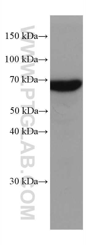Western Blot (WB) analysis of mouse brain tissue using KGA-Specific Monoclonal antibody (66265-2-Ig)