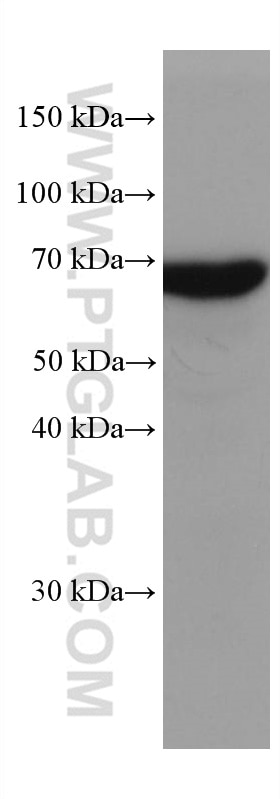 WB analysis of mouse brain using 66265-2-Ig