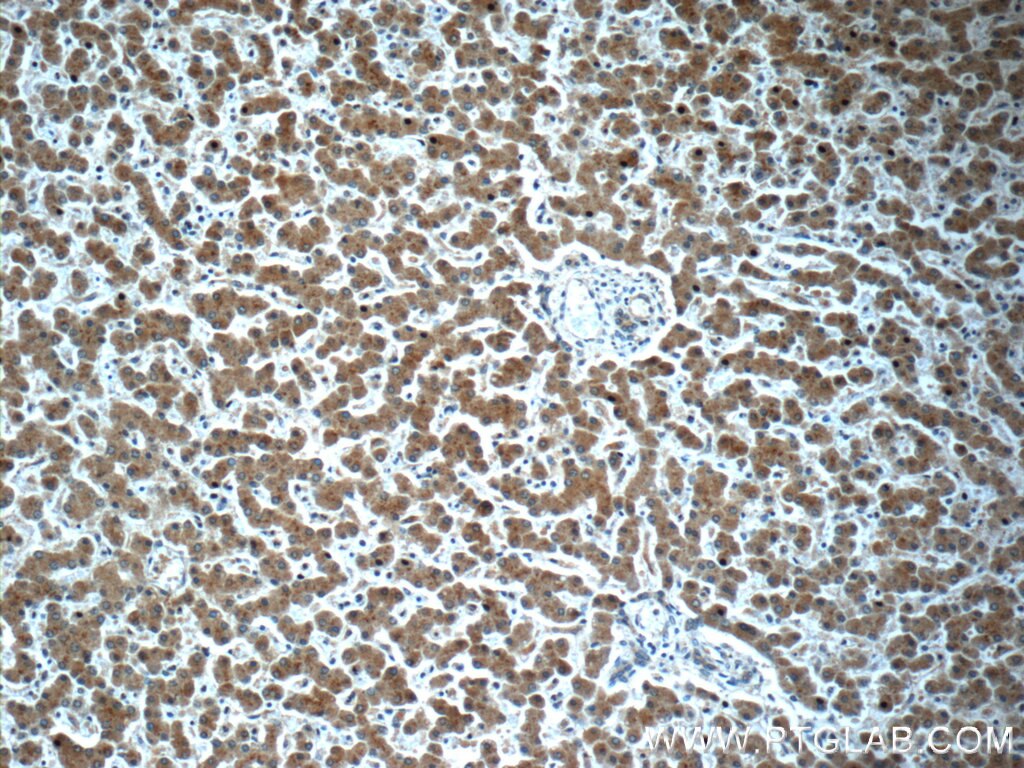 Immunohistochemistry (IHC) staining of human liver tissue using KHDC1 Polyclonal antibody (23443-1-AP)