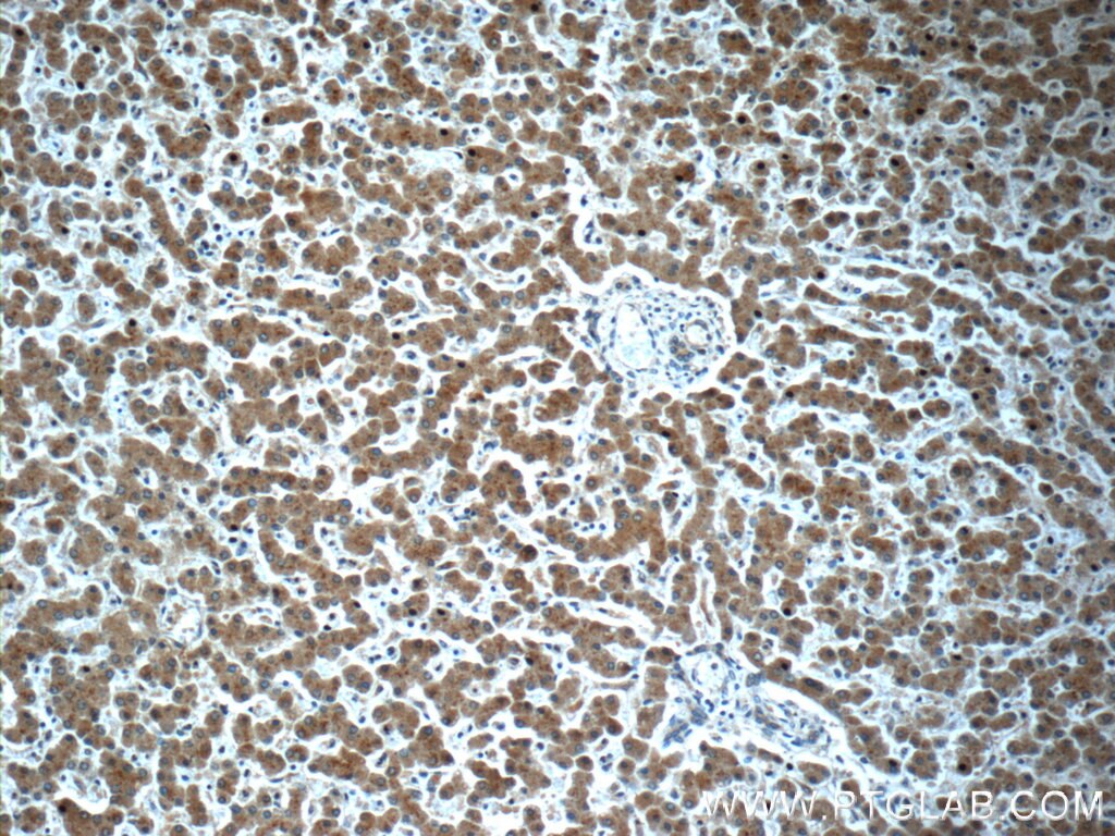 IHC staining of human liver using 23443-1-AP