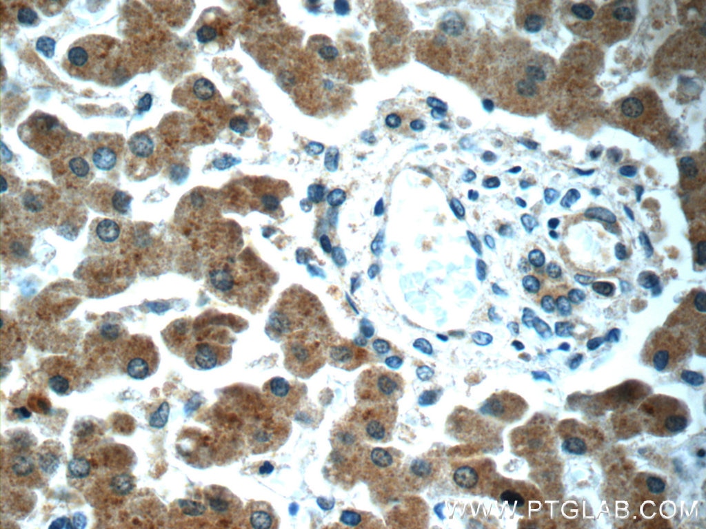 IHC staining of human liver using 23443-1-AP