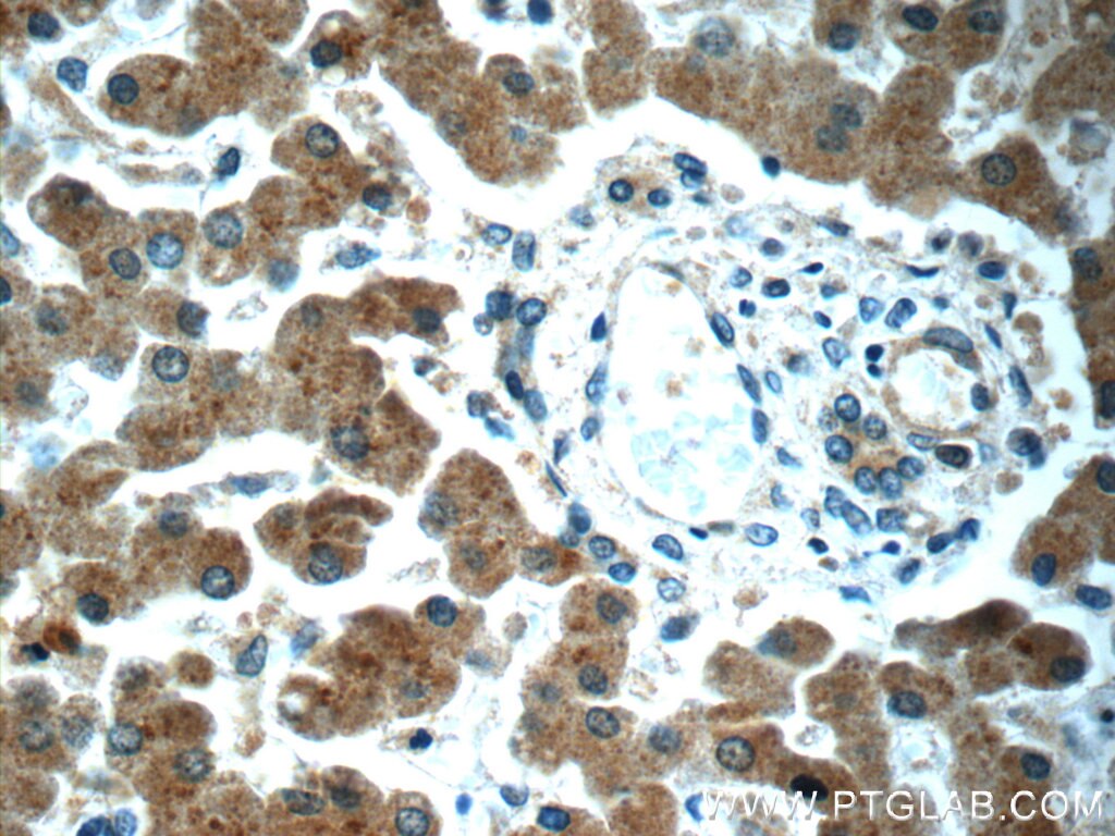 Immunohistochemistry (IHC) staining of human liver tissue using KHDC1 Polyclonal antibody (23443-1-AP)