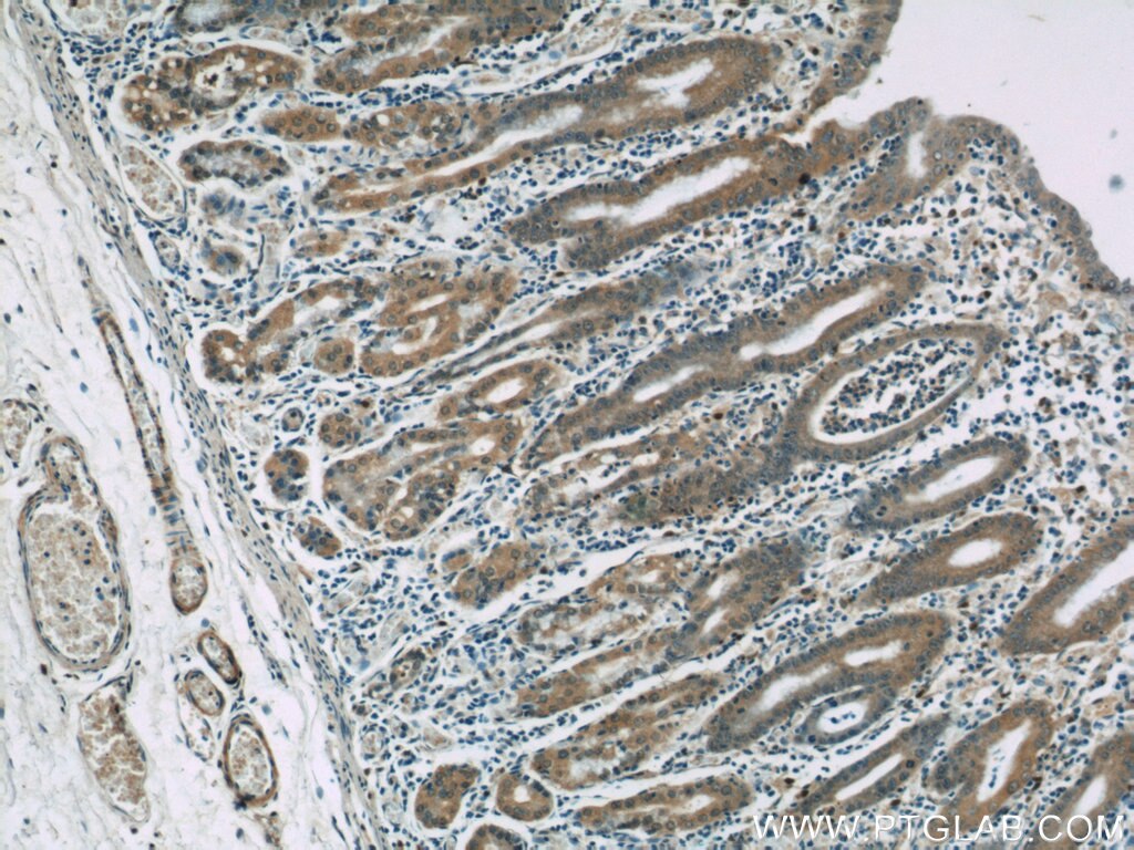 Immunohistochemistry (IHC) staining of human stomach tissue using KHDC1 Polyclonal antibody (23443-1-AP)