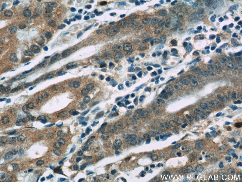 Immunohistochemistry (IHC) staining of human stomach tissue using KHDC1 Polyclonal antibody (23443-1-AP)