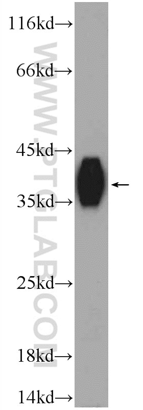 Western Blot (WB) analysis of L02 cells using KHDC1 Polyclonal antibody (23443-1-AP)