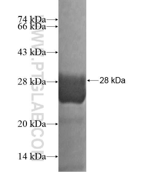 KHDC1 fusion protein Ag20115 SDS-PAGE