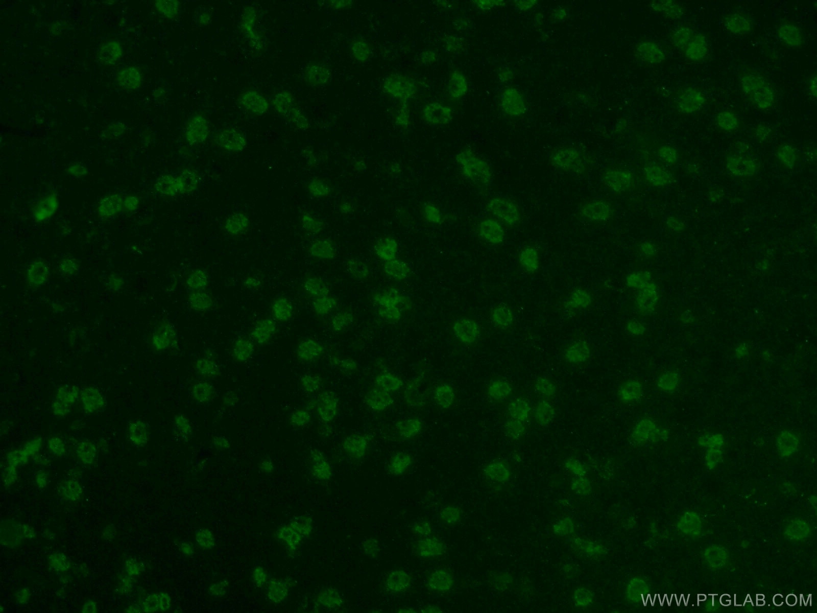 Immunofluorescence (IF) / fluorescent staining of mouse brain tissue using Sam68 Polyclonal antibody (10222-1-AP)