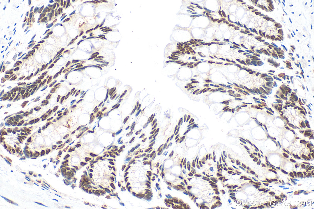 Immunohistochemistry (IHC) staining of mouse colon tissue using Sam68 Polyclonal antibody (10222-1-AP)