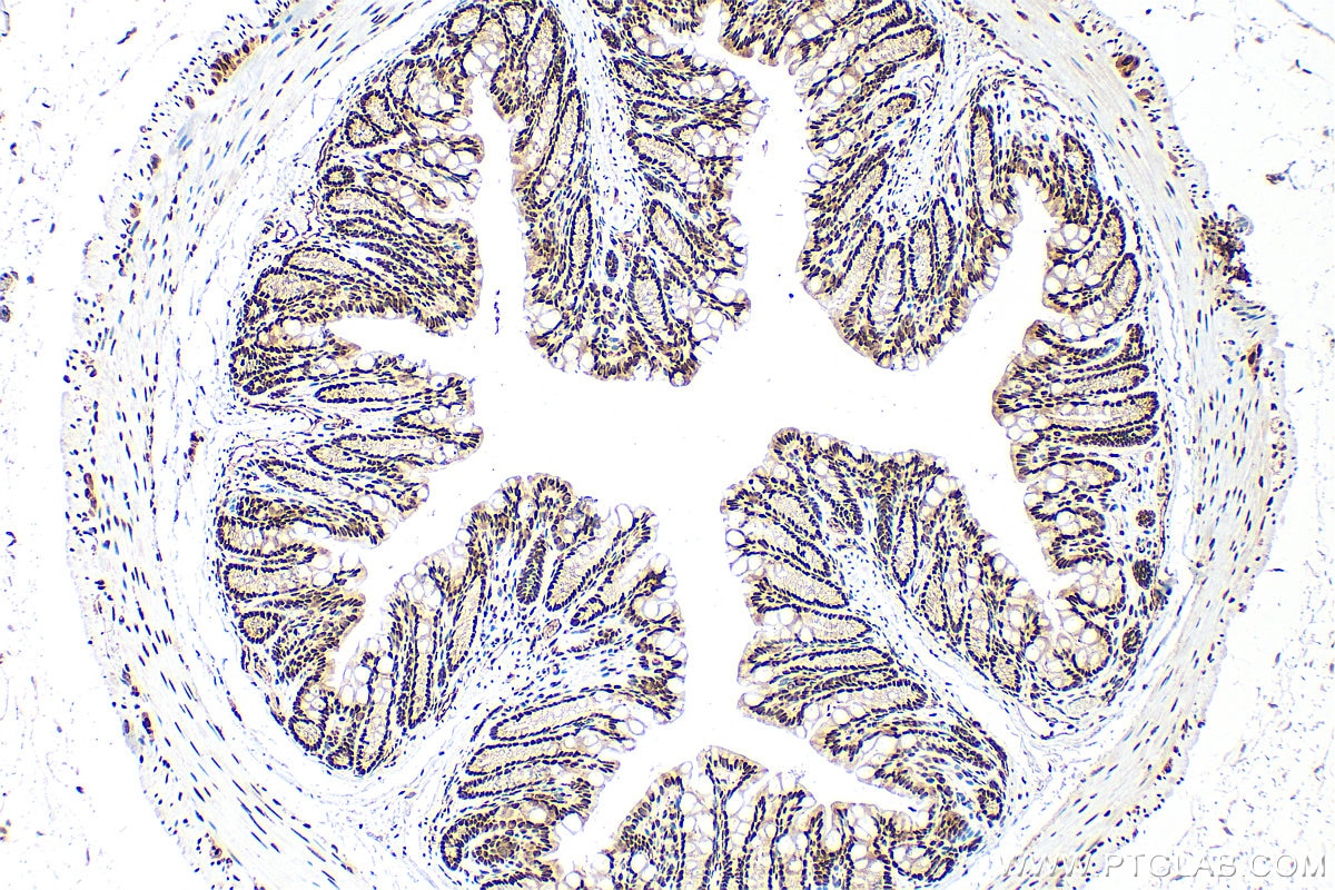 Immunohistochemistry (IHC) staining of mouse colon tissue using Sam68 Polyclonal antibody (10222-1-AP)